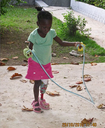 A girl with a prosthetic leg learning to skip